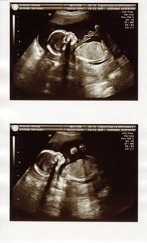 Quiggley%20Sonogram1.jpg