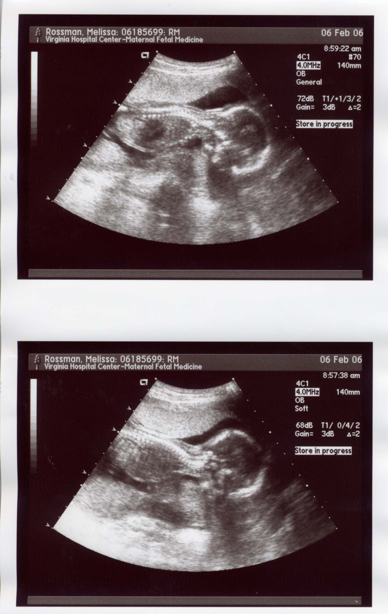 Sonogram-2.jpg